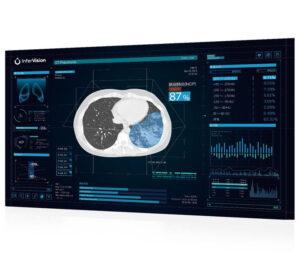 ディープラーニング技術が迅速な医師の読影を支える